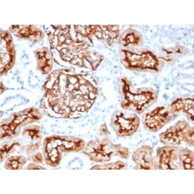 Immunohistochemistry - Anti-CD10 Antibody [MME/6714] (A277713) - Antibodies.com