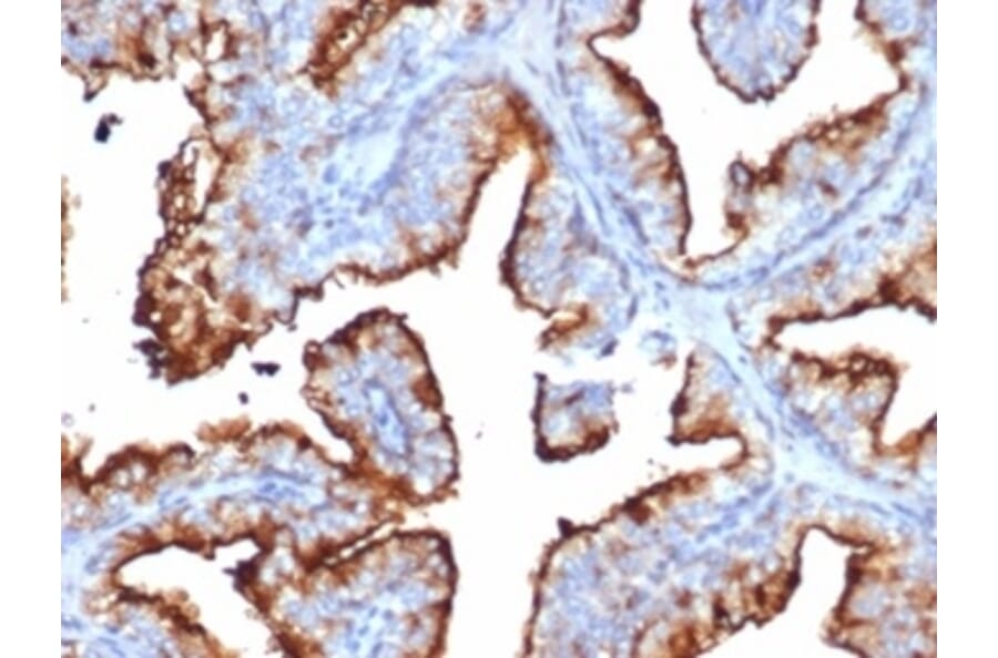 Immunohistochemistry - Anti-CD10 Antibody [MME/6714] (A277713) - Antibodies.com