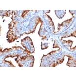 Immunohistochemistry - Anti-CD10 Antibody [MME/6714] (A277713) - Antibodies.com