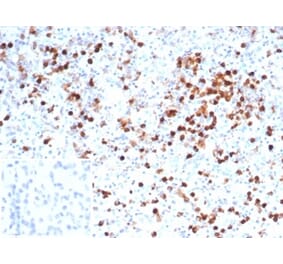 Immunohistochemistry - Anti-Myeloperoxidase Antibody [MPO/7116] (A277714) - Antibodies.com