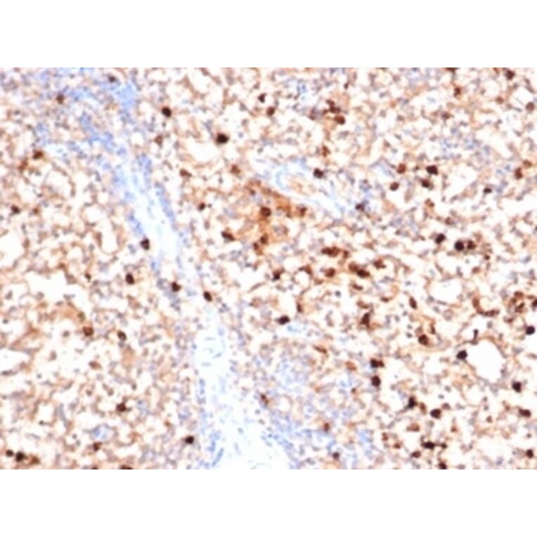 Immunohistochemistry - Anti-Myeloperoxidase Antibody [MPO/7116] (A277714) - Antibodies.com
