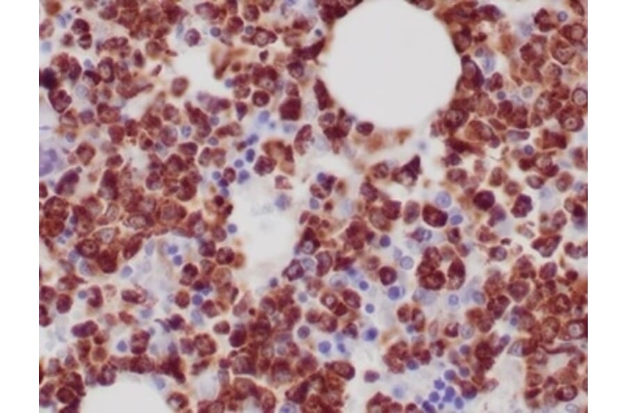 Immunohistochemistry - Anti-Myeloperoxidase Antibody [MPO/7118] (A277715) - Antibodies.com