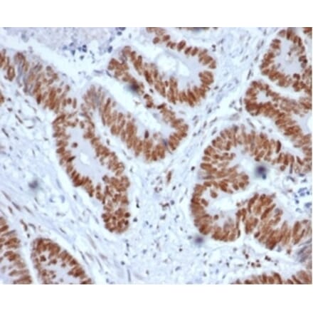 Immunohistochemistry - Anti-MSH2 Antibody [MSH2/6852] (A277717) - Antibodies.com