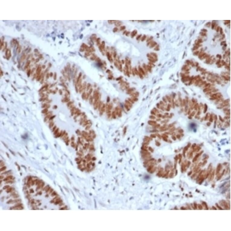 Immunohistochemistry - Anti-MSH2 Antibody [MSH2/6852] (A277717) - Antibodies.com