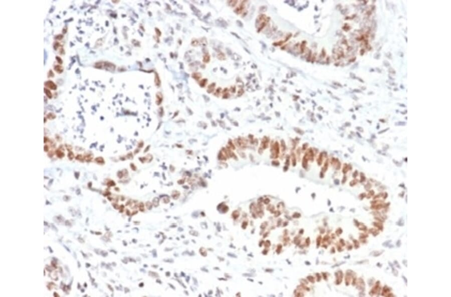 Immunohistochemistry - Anti-MSH2 Antibody [MSH2/6852] (A277717) - Antibodies.com