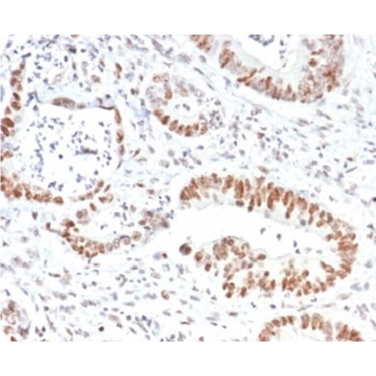 Immunohistochemistry - Anti-MSH2 Antibody [MSH2/6852] (A277717) - Antibodies.com