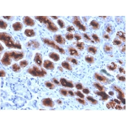 Immunohistochemistry - Anti-MUC1 Antibody [Mc5] (A277718) - Antibodies.com