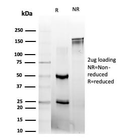 SDS-PAGE analysis of Anti-L-Myc Antibody [PCRP-MYCL-2D5] under non-reduced and reduced conditions; showing intact IgG and intact heavy and light chains, respectively. SDS-PAGE analysis confirms the integrity and purity of the antibody.