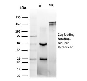 SDS-PAGE - Anti-L-Myc Antibody [PCRP-MYCL-2D5] (A277719) - Antibodies.com