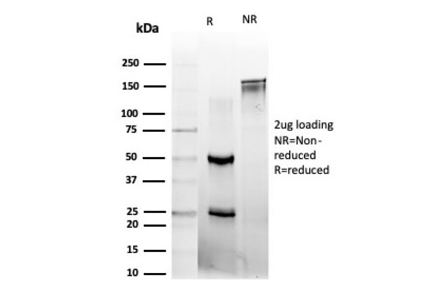 SDS-PAGE - Anti-L-Myc Antibody [PCRP-MYCL-2D5] (A277719) - Antibodies.com