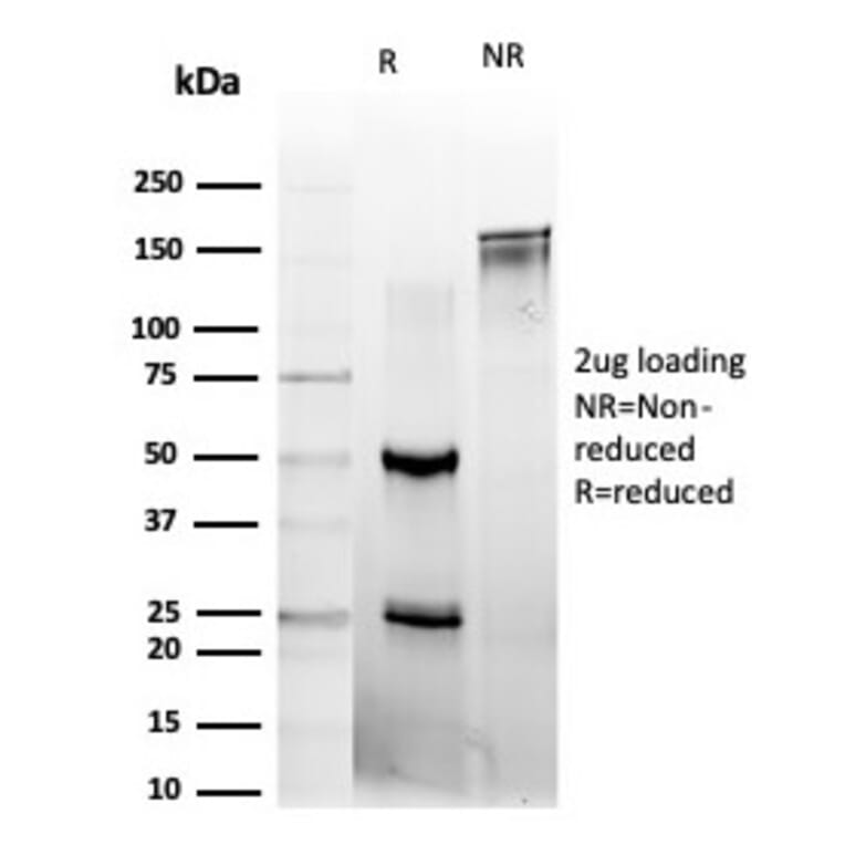 SDS-PAGE - Anti-L-Myc Antibody [PCRP-MYCL-2D5] (A277719) - Antibodies.com