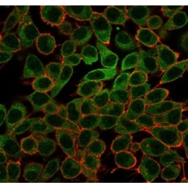 Immunofluorescence - Anti-L-Myc Antibody [PCRP-MYCL-2D5] (A277719) - Antibodies.com