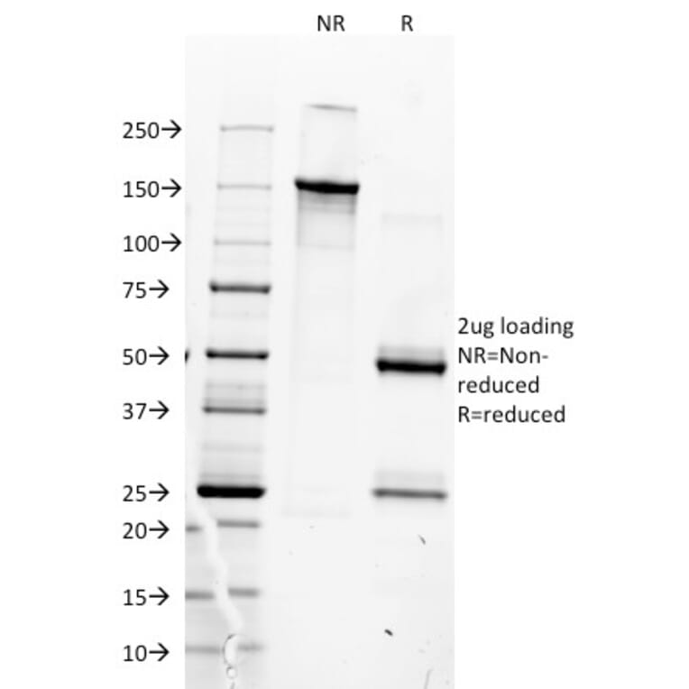 SDS-PAGE - Anti-MyoD1 Antibody [5.8A] (A277720) - Antibodies.com