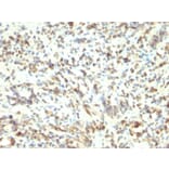Immunohistochemistry - Anti-MyoD1 Antibody [5.8A] (A277720) - Antibodies.com