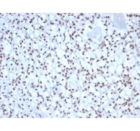 Immunohistochemistry - Anti-Nucleolin Antibody [NCL/7338] (A277722) - Antibodies.com