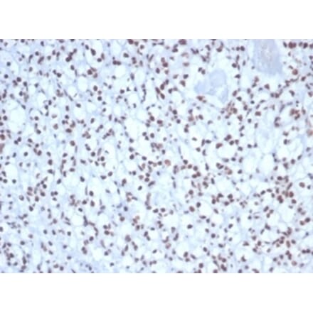 Immunohistochemistry - Anti-Nucleolin Antibody [NCL/7338] (A277722) - Antibodies.com