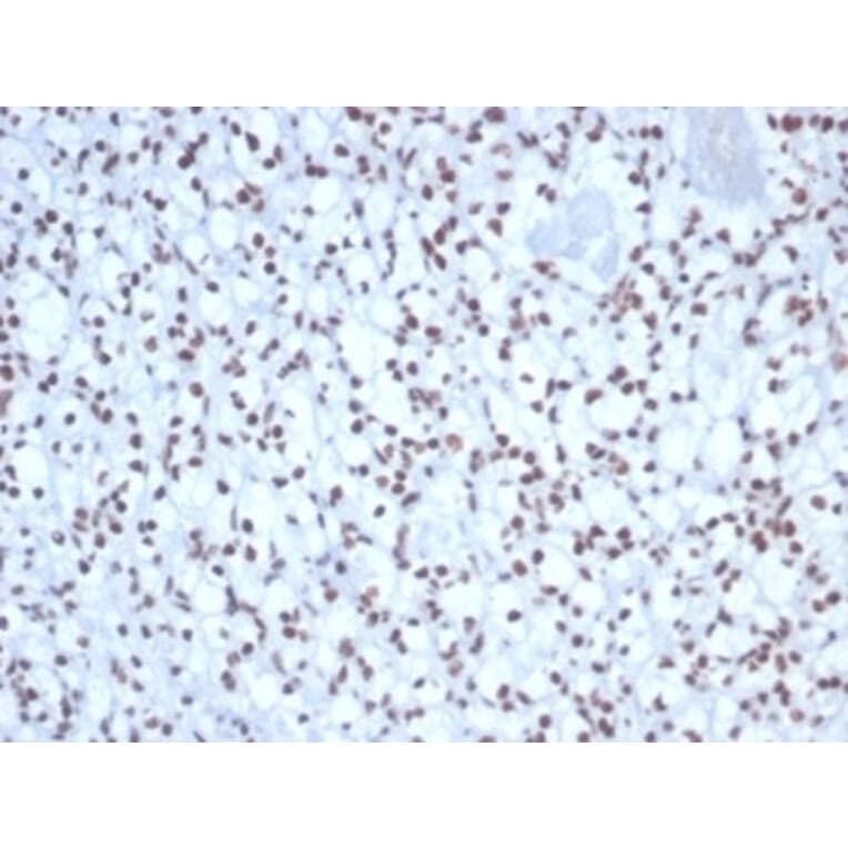 Immunohistochemistry - Anti-Nucleolin Antibody [NCL/7338] (A277722) - Antibodies.com