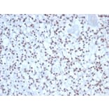 Immunohistochemistry - Anti-Nucleolin Antibody [NCL/7338] (A277722) - Antibodies.com