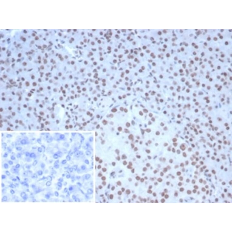Immunohistochemistry - Anti-Nucleolin Antibody [NCL/7338] (A277722) - Antibodies.com