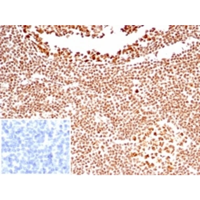 Immunohistochemistry - Anti-Nucleolin Antibody [NCL/7338] (A277722) - Antibodies.com