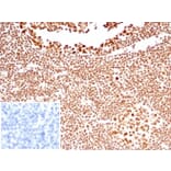 Immunohistochemistry - Anti-Nucleolin Antibody [NCL/7338] (A277722) - Antibodies.com