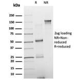 SDS-PAGE - Anti-NeuroD2 Antibody [PCRP-NEUROD2-1G1] (A277723) - Antibodies.com