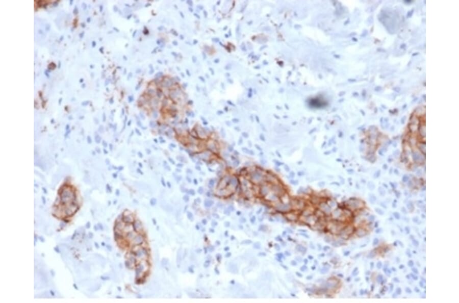 Immunohistochemistry - Anti-p75 NGF Receptor Antibody [NGFR/4919] (A277725) - Antibodies.com
