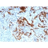 Immunohistochemistry - Anti-p75 NGF Receptor Antibody [NGFR/4919] (A277725) - Antibodies.com