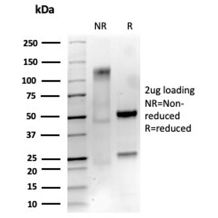 SDS-PAGE - Anti-p75 NGF Receptor Antibody [NGFR/4919] (A277725) - Antibodies.com
