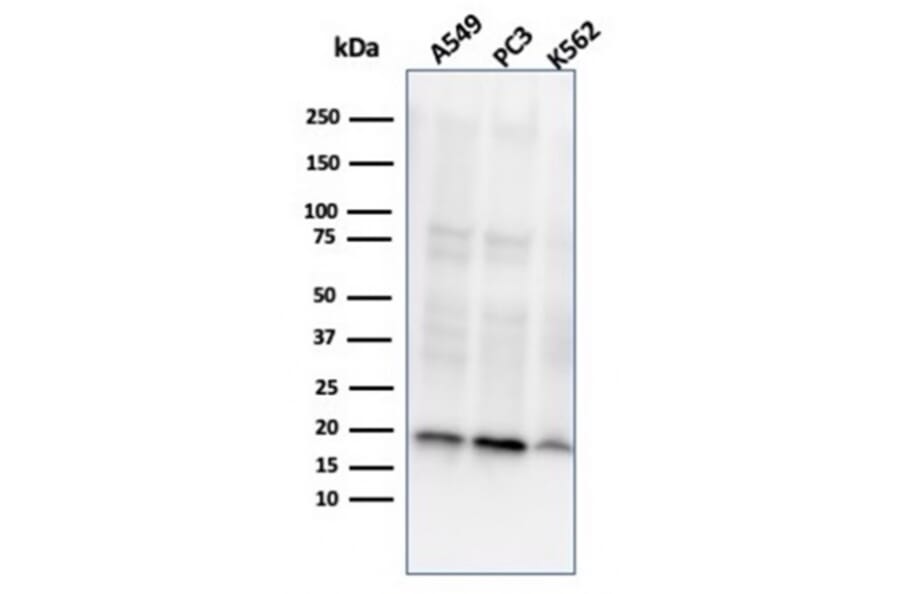 Western Blot - Anti-NME1 Antibody [NME1/2737] (A277726) - Antibodies.com