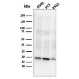 Western Blot - Anti-NME1 Antibody [NME1/2737] (A277726) - Antibodies.com