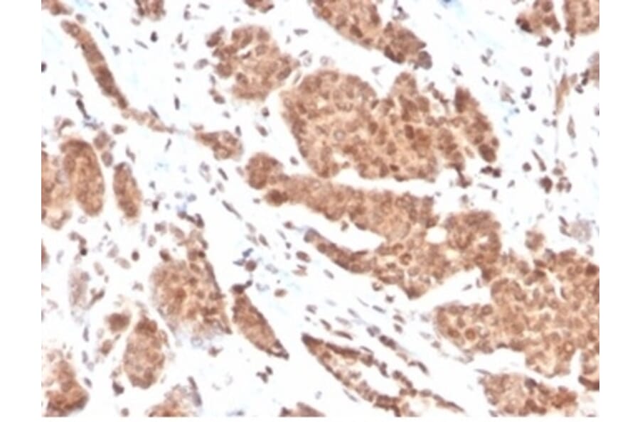 Immunohistochemistry - Anti-NME1 Antibody [NME1/2737] (A277726) - Antibodies.com