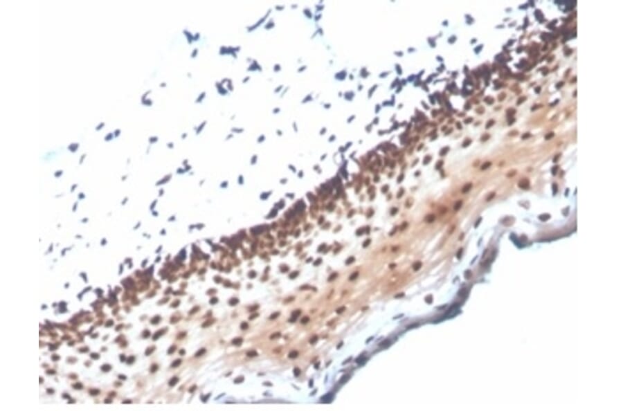 Immunohistochemistry - Anti-NME1 Antibody [NME1/2737] (A277726) - Antibodies.com