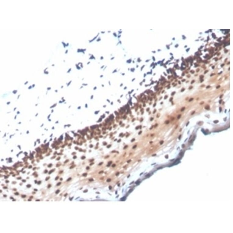 Immunohistochemistry - Anti-NME1 Antibody [NME1/2737] (A277726) - Antibodies.com