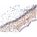 Immunohistochemistry - Anti-NME1 Antibody [NME1/2737] (A277726) - Antibodies.com