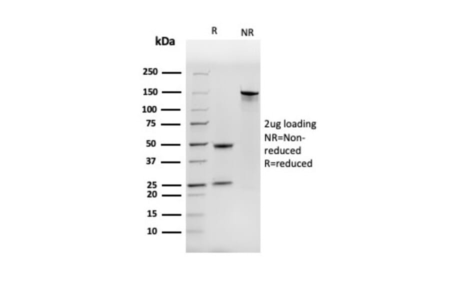 SDS-PAGE - Anti-NME1 Antibody [NME1/2737] (A277726) - Antibodies.com