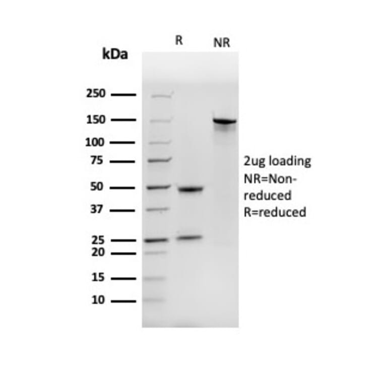 SDS-PAGE - Anti-NME1 Antibody [NME1/2737] (A277726) - Antibodies.com