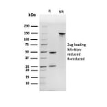 SDS-PAGE - Anti-NME1 Antibody [NME1/2737] (A277726) - Antibodies.com