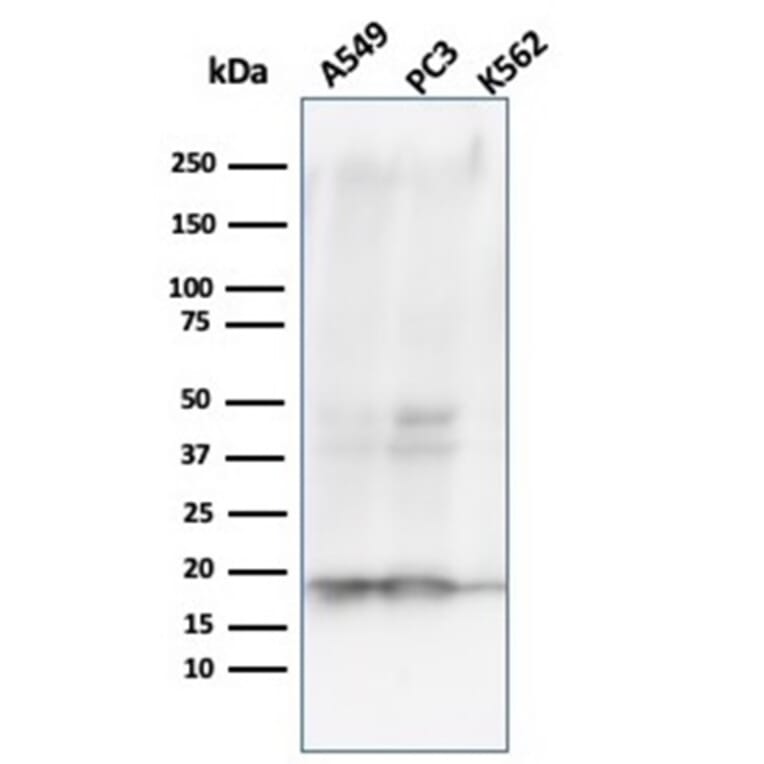 Western Blot - Anti-NME1 Antibody [NME1/2738] (A277727) - Antibodies.com