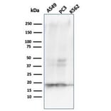 Western Blot - Anti-NME1 Antibody [NME1/2738] (A277727) - Antibodies.com