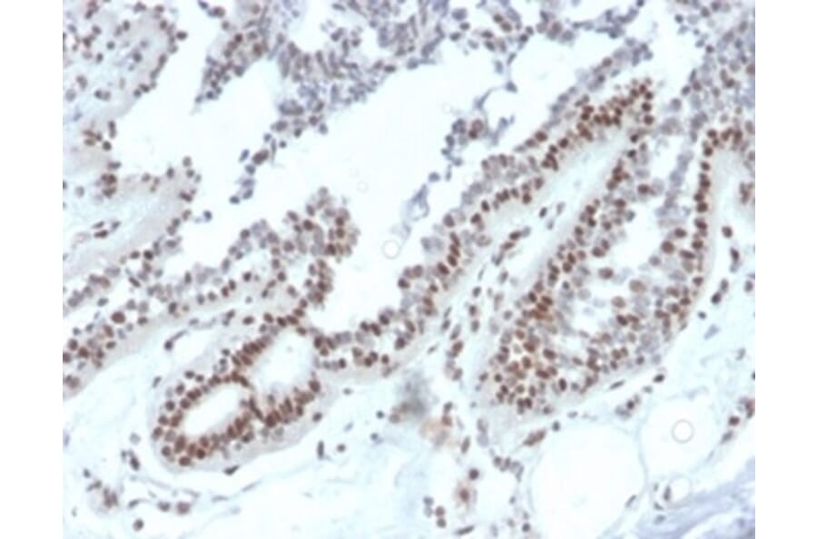 Immunohistochemistry - Anti-NME1 Antibody [NME1/2738] (A277727) - Antibodies.com