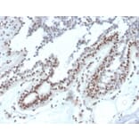Immunohistochemistry - Anti-NME1 Antibody [NME1/2738] (A277727) - Antibodies.com