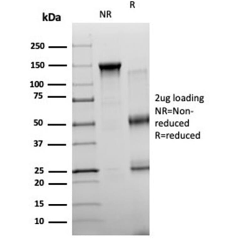 SDS-PAGE - Anti-NeuroG3 Antibody [PCRP-NEUROG3-1E10] (A277730) - Antibodies.com