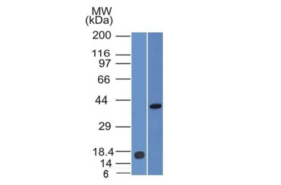 Western Blot - Anti-PAX2 Antibody [PAX2/1105] (A277731) - Antibodies.com