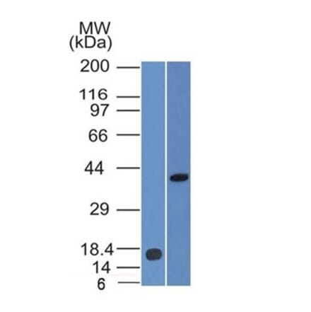 Western Blot - Anti-PAX2 Antibody [PAX2/1105] (A277731) - Antibodies.com