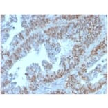 Immunohistochemistry - Anti-PAX2 Antibody [PAX2/1105] (A277731) - Antibodies.com