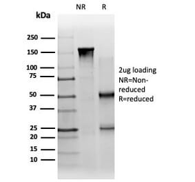 SDS-PAGE - Anti-PBX1 Antibody [PCRP-PBX1-3C8] (A277732) - Antibodies.com