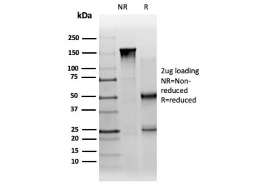 SDS-PAGE - Anti-PBX1 Antibody [PCRP-PBX1-3C8] (A277732) - Antibodies.com