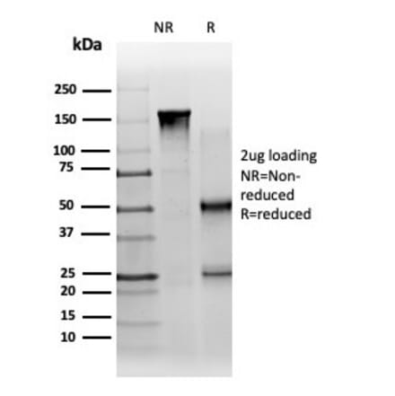 SDS-PAGE - Anti-PBX1 Antibody [PCRP-PBX1-3C8] (A277732) - Antibodies.com