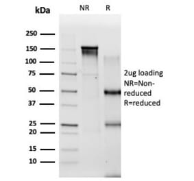 SDS-PAGE - Anti-PBX2 Antibody [PCRP-PBX2-1C4] (A277733) - Antibodies.com